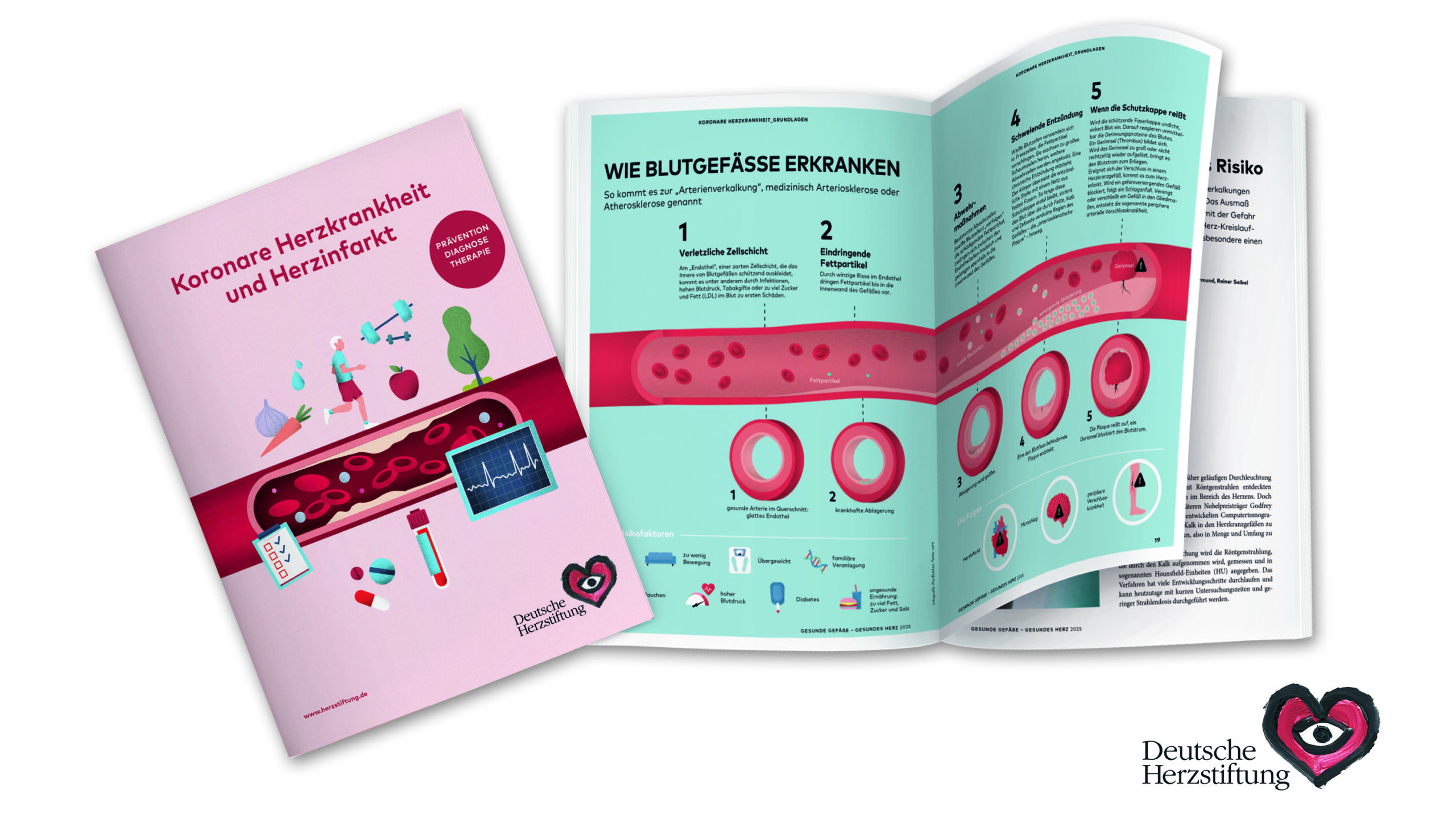 Grafik: Deutsche Herzstiftung